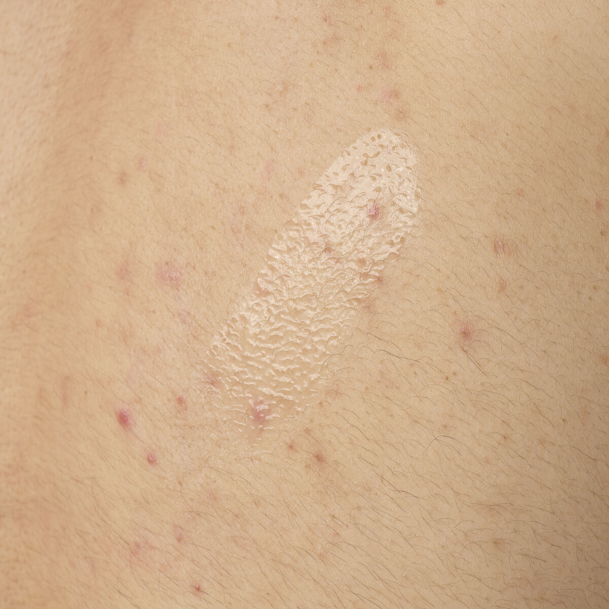 salicylic-acid-0-5-body-serum-o0 ORD-salicylic-acid-05-body-240ml-application.jpg