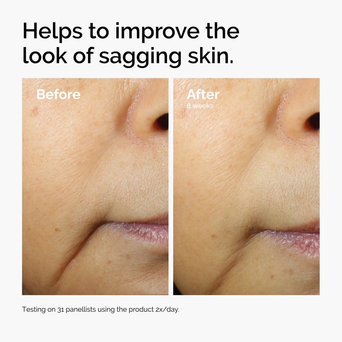 caffeine-3-escin-1-face-serum-n0 ord-caffeine-3pct-escin-1pct-face-serum-before-after-sagging.jpg