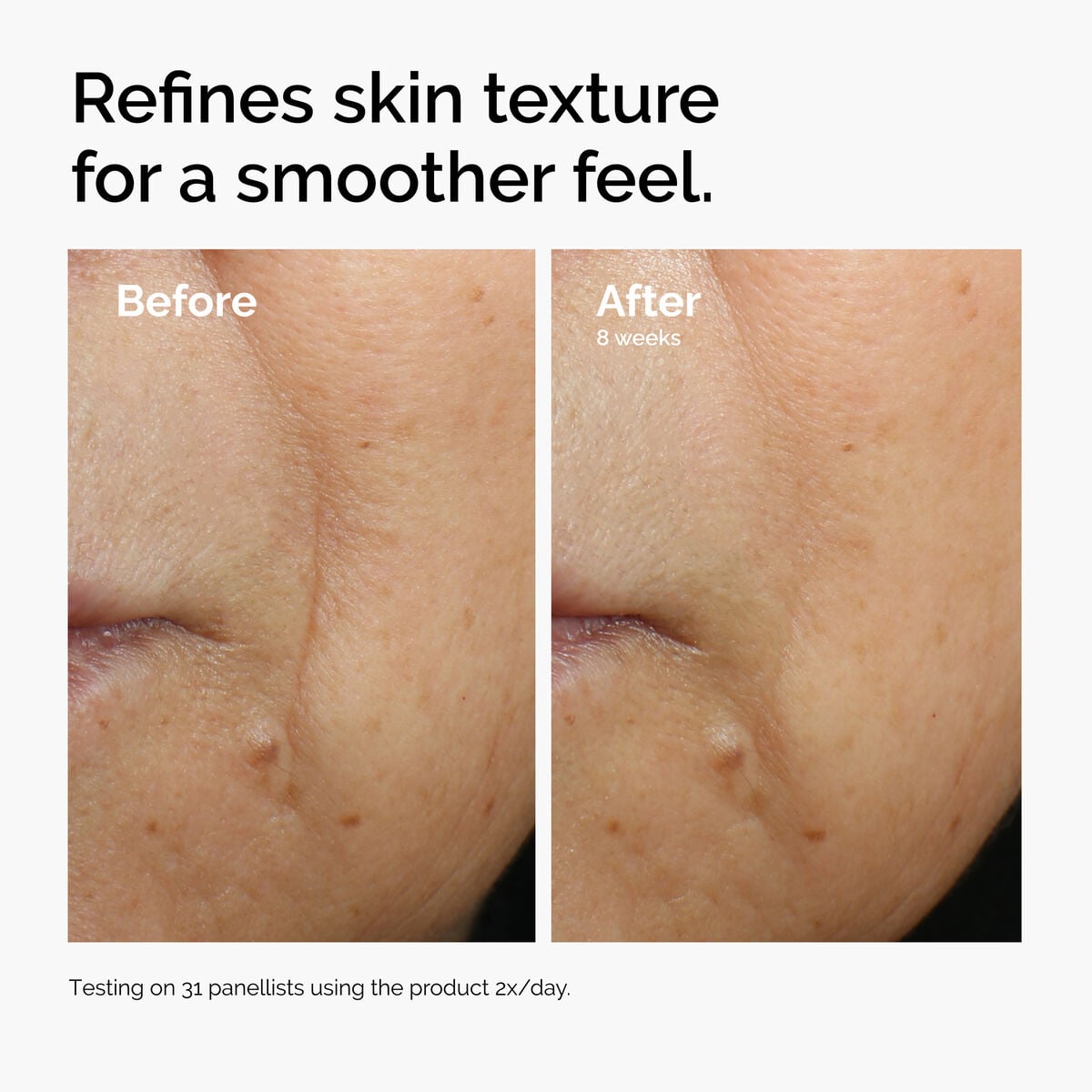 caffeine-3-escin-1-face-serum-n0 ord-caffeine-3pct-escin-1pct-face-serum-before-after-texture.jpg