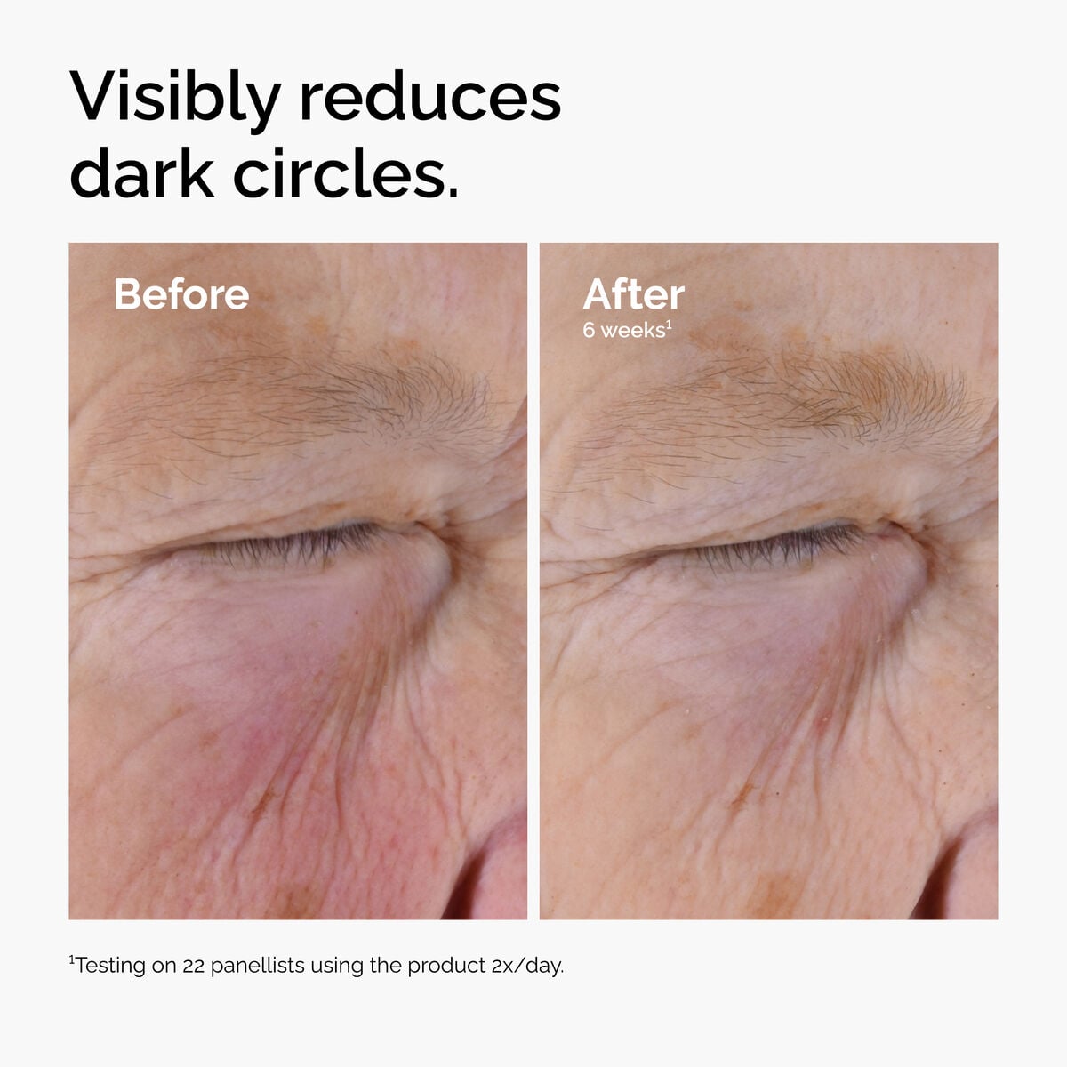 caffeine-solution-5-egcg-eye-serum-z6 ord-caffeine-solution-egcg-dark-circles-before-after.jpg