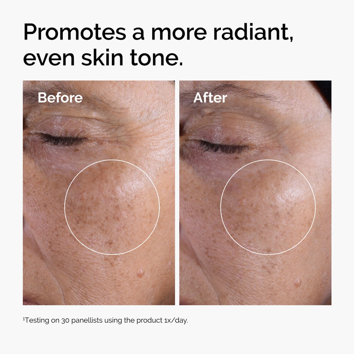 glycolic-acid-7-exfoliating-toner-e3 ord-glycolic-before-after-radiance.jpg