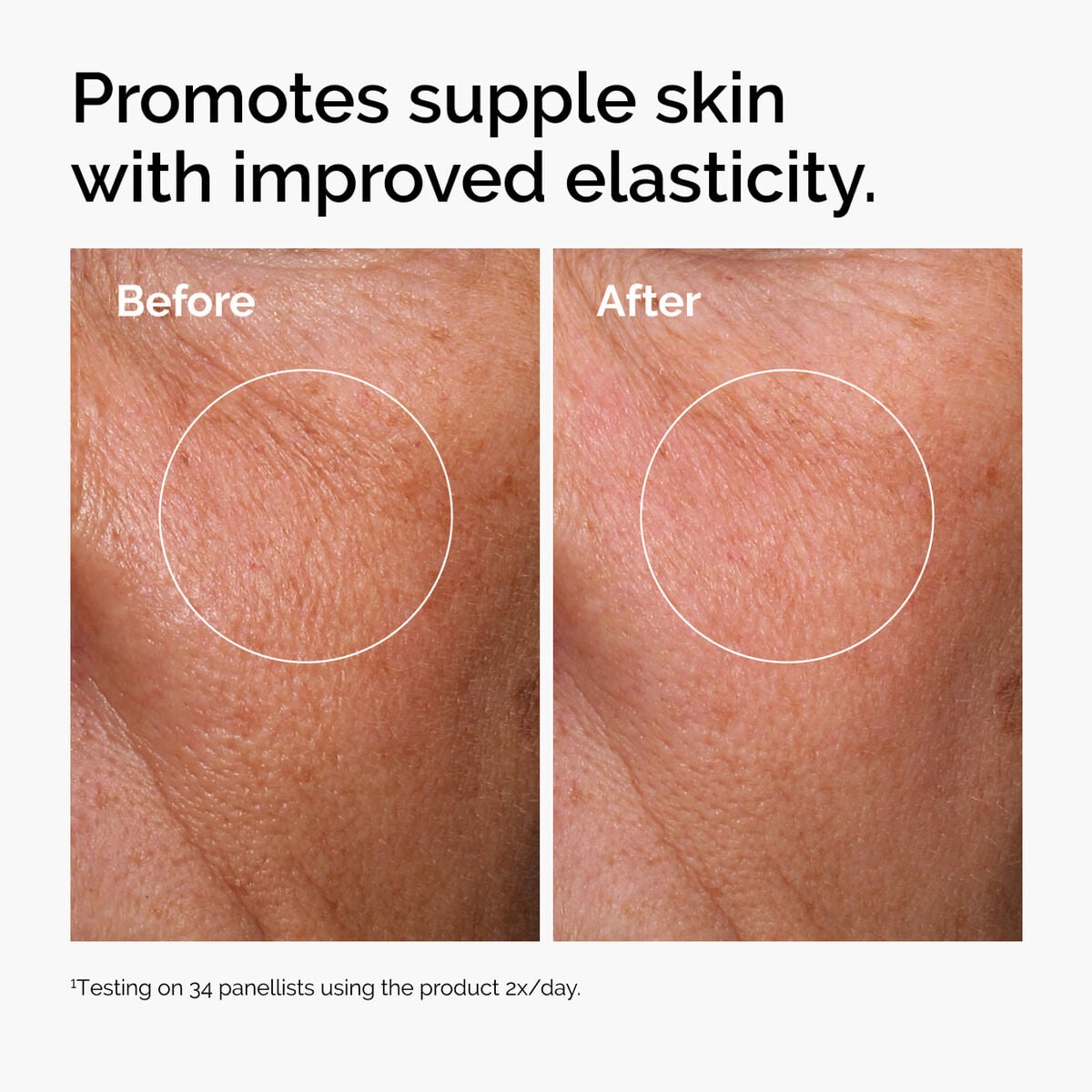 hyaluronic-acid-2-b5-with-ceramides-c1 ord-hyaluronic-acid-2pct-b5-hydrating-serum-before-after-elasticity.jpg