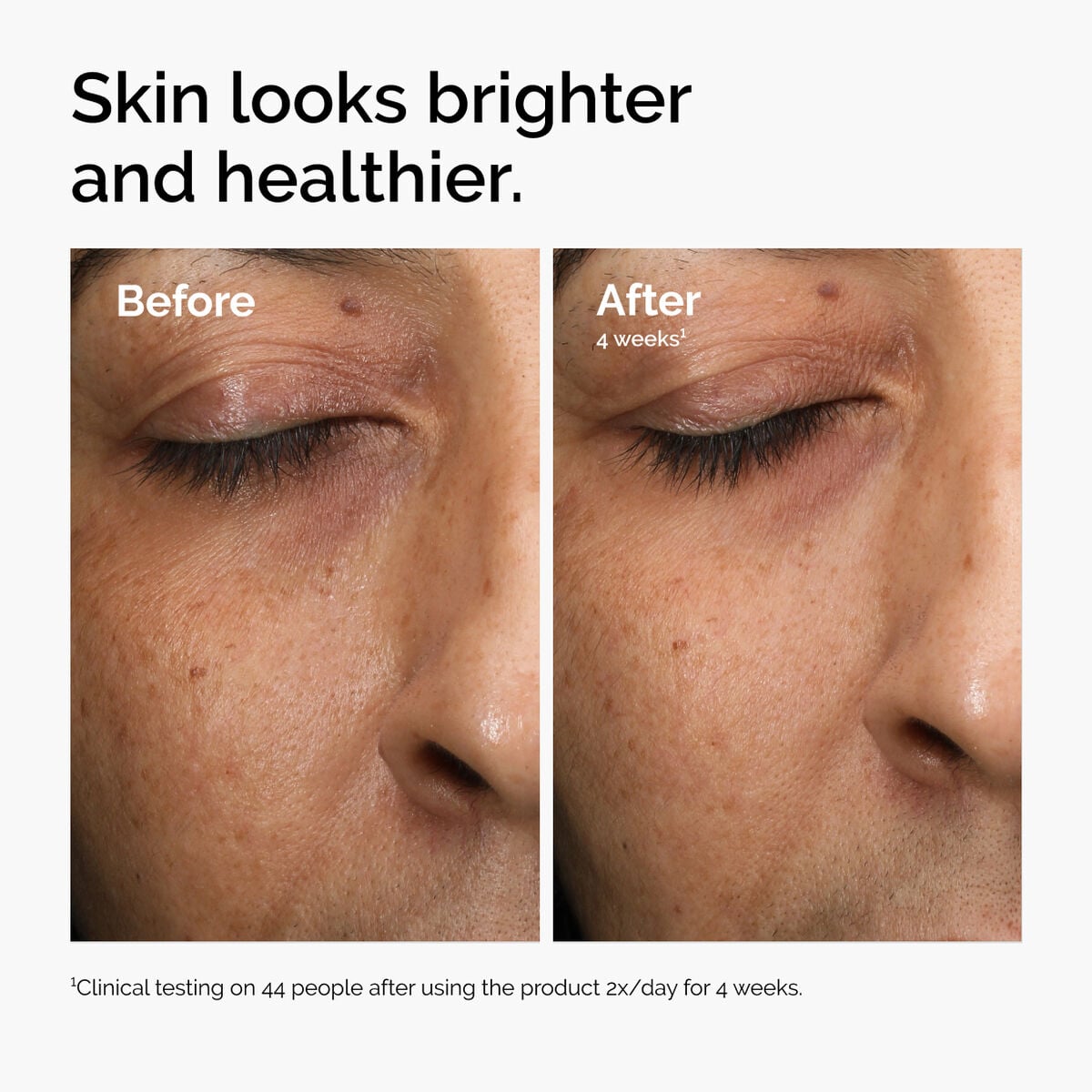 multi-antioxidant-radiance-serum-z0 ord-mars-before-after-healthy.jpg