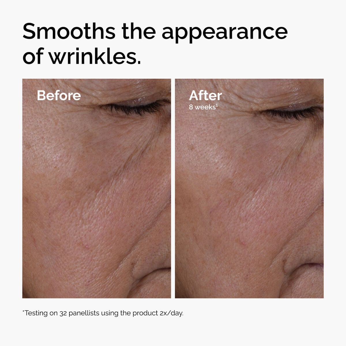 multi-peptide-ha-serum-p9 ord-multi-peptide-ha-serum-wrinkles-before-after.jpg