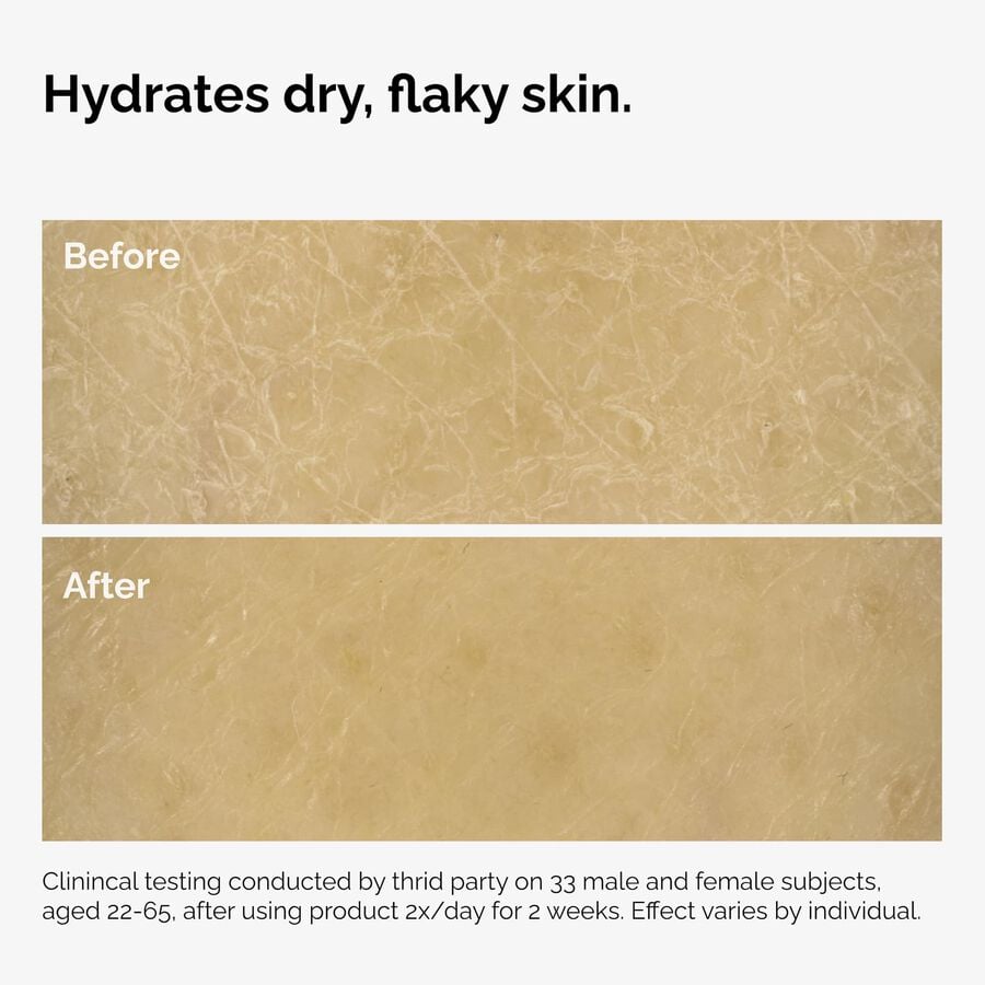 the-body-care-collection-s3 ord-natural-moisturizing-factors-inulin-body-before-after-graphic-02.jpg