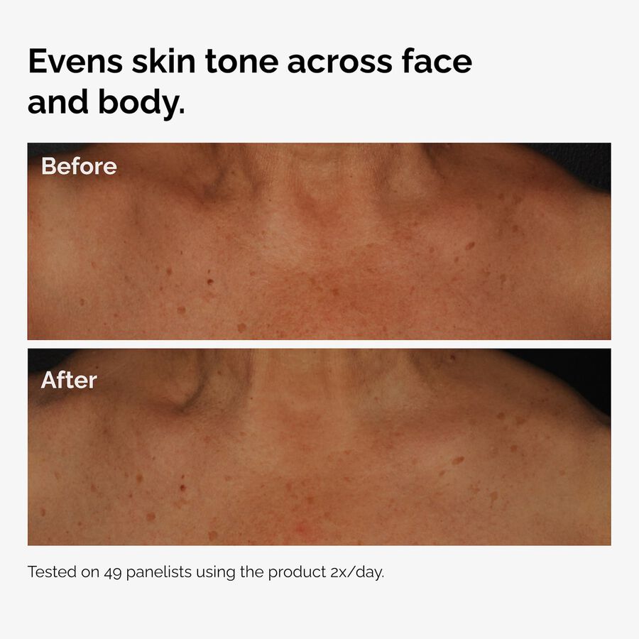 the-body-care-collection-s3 ord-niacinamide-face-body-serum-before-after-even-tone-graphic.jpg
