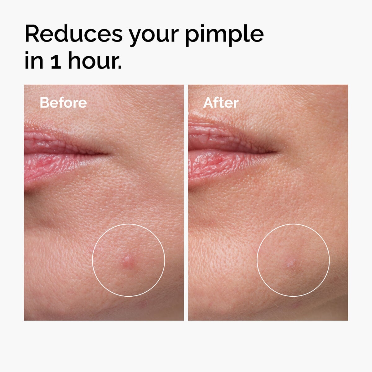 sulfur-10-powder-to-cream-concentrate-j1 ord-sulfur-10pct-powder-to-cream-concentrate-before-after-NA.jpg