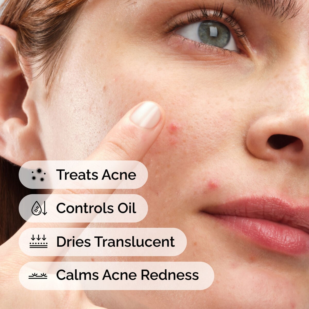 sulfur-10-powder-to-cream-concentrate-j1 ord-sulfur-10pct-powder-to-cream-concentrate-model-application-with-benefits-acne.jpg